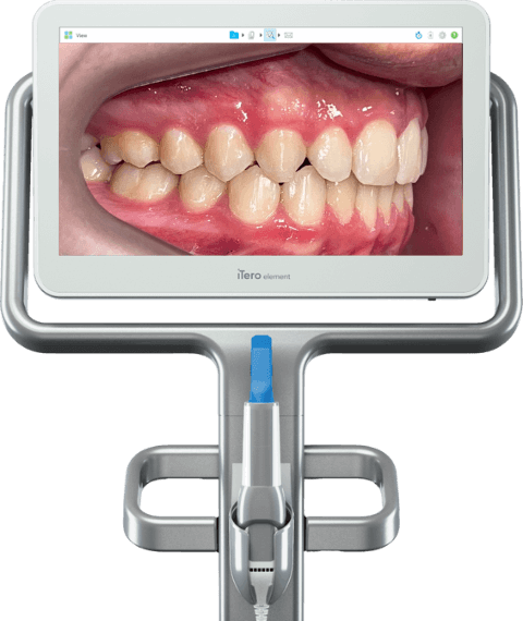 Invisalign - Clínica Odontológica Prime Dente - Méier _ RJ